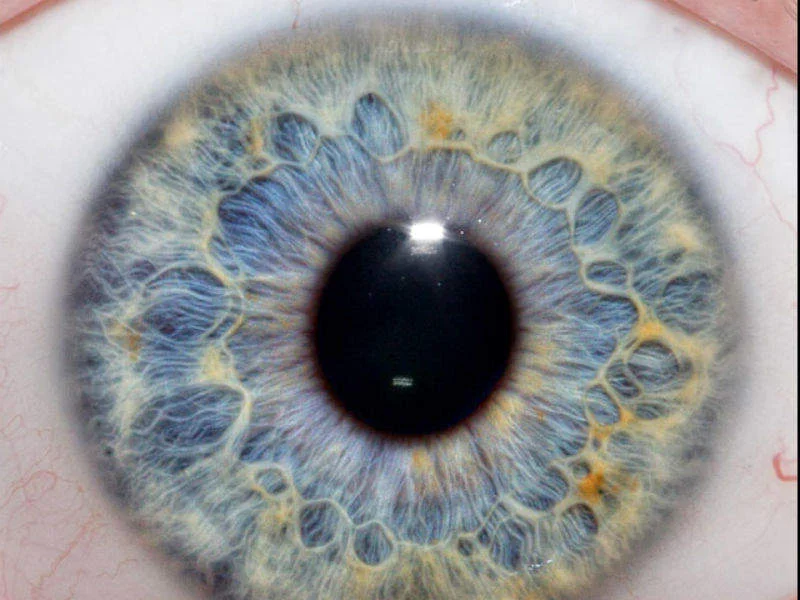 iris-goz