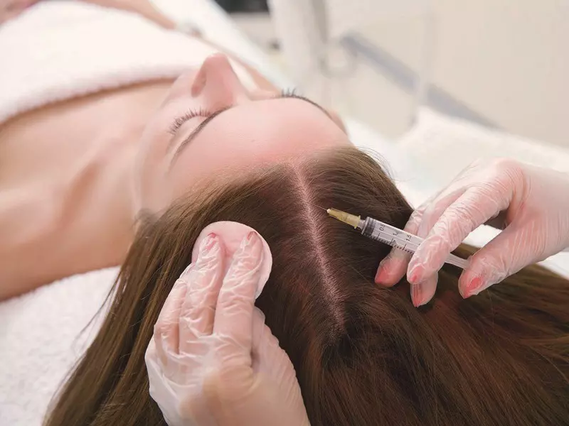 Dermapen ile Sac Mezoterapisi