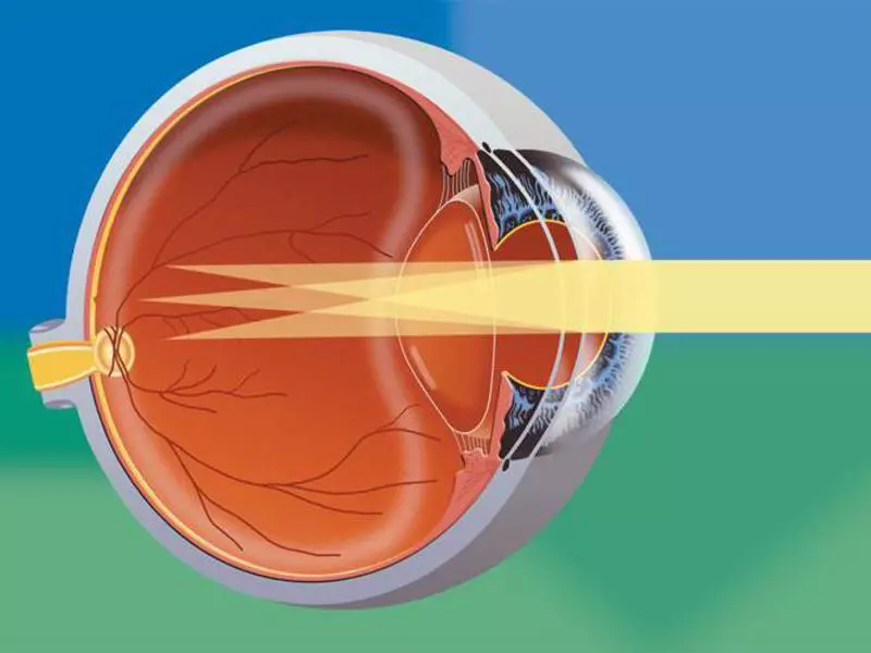 lumineyes yapan doktorlar