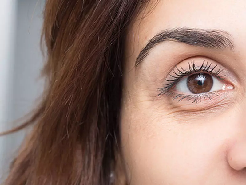 goz-alti-torbalarinin-ve-morluklarin-ilacla-tedavisi-var-mi