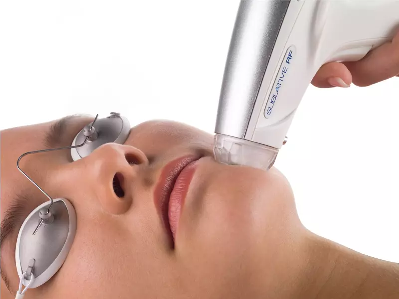 atlanta laser depigmentation