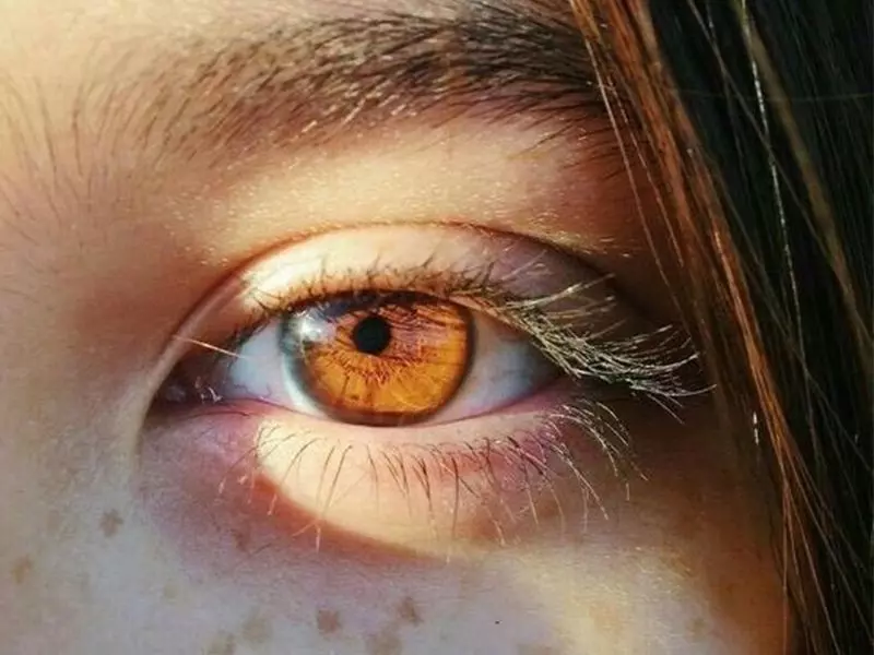 goz rengi degisimi icin muayene