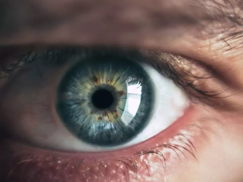 ameliyatla-goz-rengi-degistirme